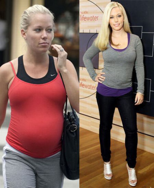 Во время и после беременности