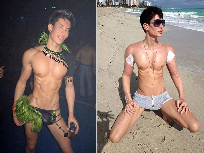 Жертвы пластической хирургии